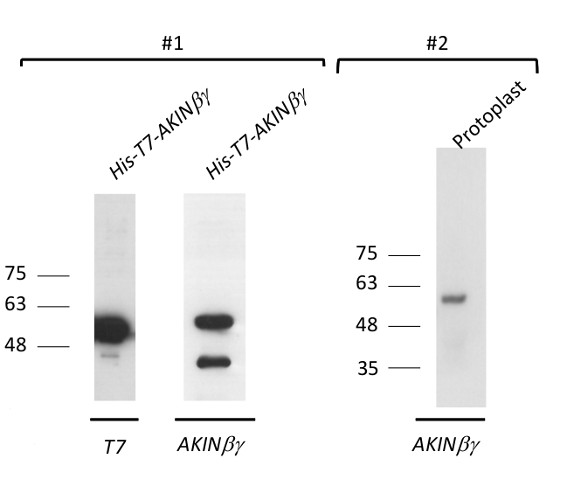 western blot using anti-AKIN beta gamma antibodies